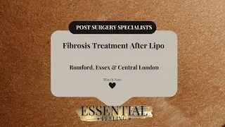 What Helps You Heal Faster After Liposuction? Essential Tips & Tricks