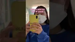 Getting a new eye!! #eyecancer #prosthetic #eye #korean #aapi