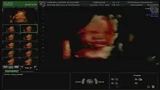 BB Precious Live Stream