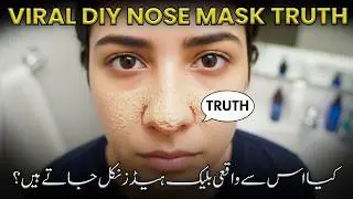 DIY Nose Strips for Blackheads &ndash; Blackheads Remove Karny Ka Safe Tarika | Skin Care Tips