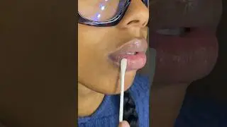 I know y&rsquo;all see that difference🤯| ⚠️ DONT peel lips before doing #skincaretips #applecidervinegar