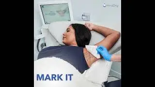 3 Steps to Permanently Reduce Underarm Sweat with MiraDry&reg; 💧