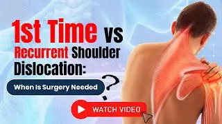 First Time vs Recurrent Shoulder Dislocation: Who Really Needs Surgery? | In Delhi
