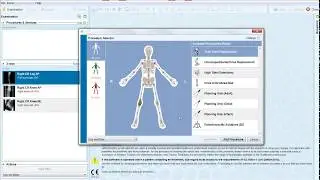 Total Knee Planning on a Full leg AP Image | Materialise Medical