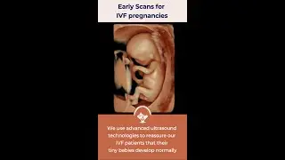 Early scans specially designed for IVF pregnancies