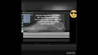 TSK JANDARMA SAĞLIK RAPORU ORTOPEDİ D&Uuml;Z TABAN (PES PLANUS) A&Ccedil;I &Ouml;L&Ccedil;&Uuml;M&Uuml; E-NABIZ #Shorts