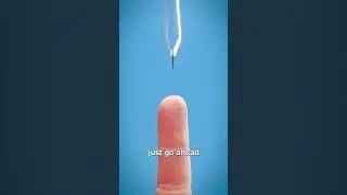 If you get a splinter #skincare #splinter #doctor #splintertalk #animation