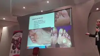 Podiatry for CMT. Robert Isaacs at the CMT UK 2019 conference