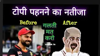 Long And Healthy Hair | Baldness Problem in Early Age | Hair Regrowth | Interesting facts | Check In