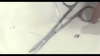 Double Mounting with Micropin Pinning Technique