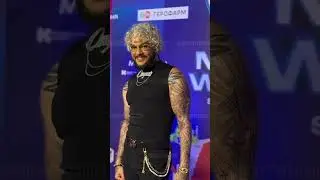 Киркоров вставил импланты?!