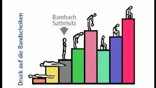 Bambach Sattelsitz - эрготерапевтический специальный стул-седло | Bambach (Германия)