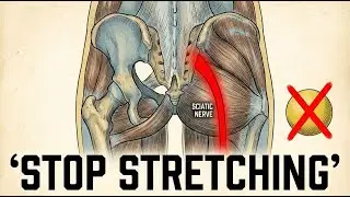 Stop Stretching Your Glute: The 94% Diagnosis Error