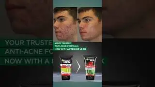 acno fight face wash uses #trending #shorts #beauty