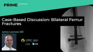 Case-Based Discussion: Bilateral Femur Fractures - James Learned, MD