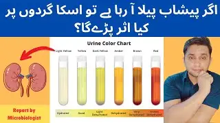 Effect of Urine color on your Health (2025)