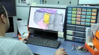 |Dental Laboratory Services|Cosmentic Dental Laboratory| |Implant Dental Laboratory| 800-336-3053