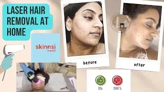 Laser hair removal at home - make O skinnsi- do’s & don’ts - first session | Vriti khanna