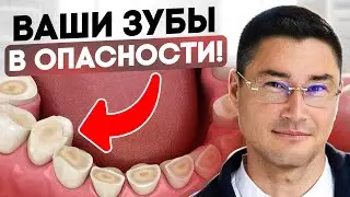 Зубы СТИРАЮТСЯ из-за этого! Почему диагноз бруксизма КАТЕГОРИЧЕСКИ нельзя игнорировать?