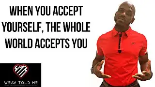 EMBRACE YOUR FLAWS & IMPERFECTIONS | Learn How To Accept And Love Yourself Unconditionally