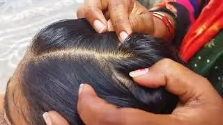 nitpicking by long hair and real sound