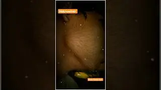 Beard growth 📈 more facial hair || How to grow facial hair #wantbeard #youtubeshorts