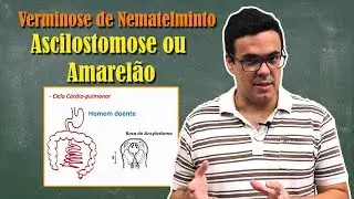 Ancilostomose, Amarel&atilde;o ou Doen&ccedil;a do Jeca Tatu