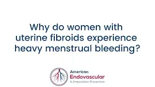Why do women with uterine fibroids experience heavy menstrual bleeding?