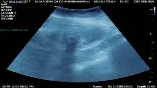 27weeks MSD