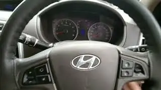 Hyundai i20 Petrol Engine Misfire and Check engine light on P0304 Fault code