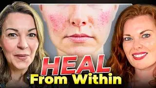 What Your Skin Is Trying To Tell You About Your Gut!