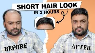 Short Hair Look in Hair Patch | Hair Transformation in just 2 Hour | Hair Wig House