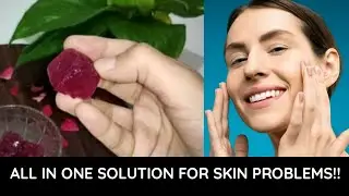 Rose Water Ice Cubes For Closing Open Pores! | Get Instant Fair & Fresh Skin