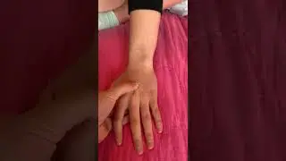Palpation: Capitate