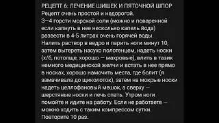 Пяточные шпоры.