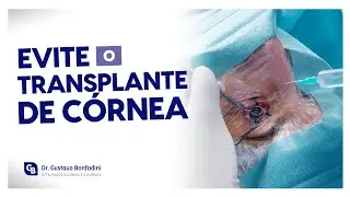 FIND OUT IF YOU NEED A CORNEA TRANSPLANT WITH CATARACT SURGERY