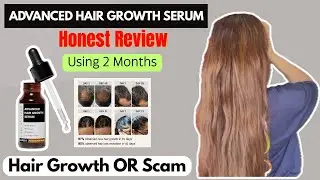 Bare Anatomy Advanced Hair Growth Serum || Hair Fall Solution Or Scam??