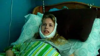 Tripping Out After Wisdom Teeth Surgery Pt. 1