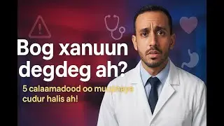 😱 Bog xanuun lama filaan ah? 5 Calaamadood oo khatar ah!