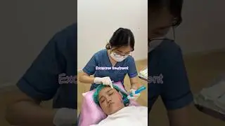 Exosome treatment for cell repair process, faster recovery #fyp #drcandy #aestheticdoctor #exosomes