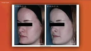 New FDA cleared acne treatment in Austin