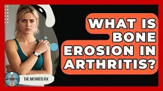 What Is Bone Erosion In Arthritis? - The Arthritis Fix