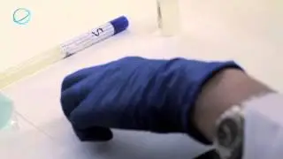 EHAS: Diagn&oacute;stico de Infecciones Vaginales (Examen en fresco)