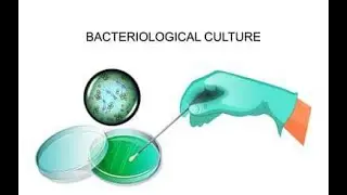 Bacteriological culture and tests for antibiotic sensitivity