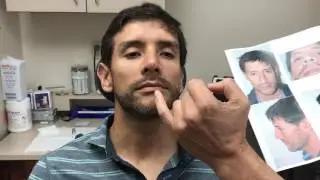 Male Rhinoplasty - Correcting the Twisted Nose | Dr. Jeffrey Epstein
