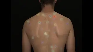 Introducting oVioAi for skin scanning technology