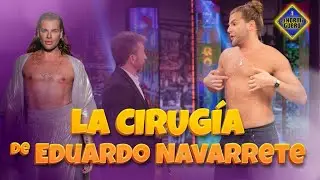 Las operaciones estéticas de Eduardo Navarrete - El Hormiguero
