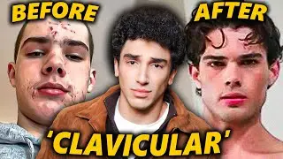 Clavicular: The Internet's Prettiest Incel