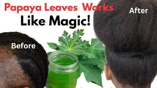 Use Papaya Leaves Once & Your Hair Will Never Stop Growing | Proven Results!