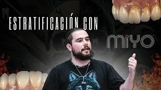 Estratificación  de MiYo David Cabeza
